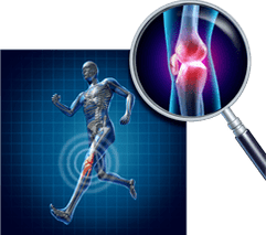 Arthrosis of knee joints